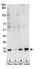 Small Nuclear Ribonucleoprotein D3 Polypeptide antibody, NBP2-22306, Novus Biologicals, Western Blot image 