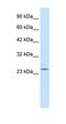 Regulator Of G Protein Signaling 13 antibody, orb329757, Biorbyt, Western Blot image 