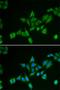 BCL2 Interacting Protein 2 antibody, STJ28204, St John