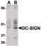 CD209 Molecule antibody, PA5-19966, Invitrogen Antibodies, Western Blot image 