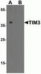 Hepatitis A Virus Cellular Receptor 2 antibody, GTX49381, GeneTex, Western Blot image 