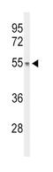 DiGeorge Syndrome Critical Region Gene 2 antibody, abx034378, Abbexa, Western Blot image 