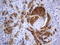 Alpha-Methylacyl-CoA Racemase antibody, LS-C796976, Lifespan Biosciences, Immunohistochemistry paraffin image 