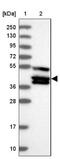 TRAF family member-associated NF-kappa-B activator antibody, NBP2-38358, Novus Biologicals, Western Blot image 