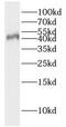 GDNF Family Receptor Alpha 3 antibody, FNab03440, FineTest, Western Blot image 