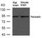 Periostin antibody, 79-660, ProSci, Western Blot image 