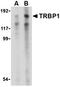 TAR (HIV-1) RNA Binding Protein 1 antibody, orb74787, Biorbyt, Western Blot image 