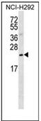 PRELI Domain Containing 3B antibody, AP53937PU-N, Origene, Western Blot image 