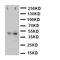 Flotillin 2 antibody, LS-C313158, Lifespan Biosciences, Western Blot image 