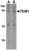 Endosialin antibody, TA306484, Origene, Western Blot image 