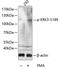 Mitogen-Activated Protein Kinase 6 antibody, GTX32415, GeneTex, Western Blot image 