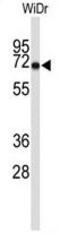 Translocase Of Outer Mitochondrial Membrane 70 antibody, GTX81747, GeneTex, Western Blot image 