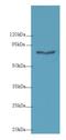 Collagen Beta(1-O)Galactosyltransferase 2 antibody, LS-C378139, Lifespan Biosciences, Western Blot image 