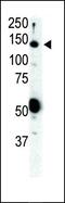 Ret Proto-Oncogene antibody, PA5-14722, Invitrogen Antibodies, Western Blot image 