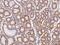 Sodium Channel Epithelial 1 Beta Subunit antibody, 206972-T08, Sino Biological, Immunohistochemistry paraffin image 