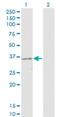 Protein Kinase AMP-Activated Non-Catalytic Subunit Gamma 2 antibody, H00051422-M01, Novus Biologicals, Western Blot image 