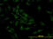 Cofilin 2 antibody, LS-C133115, Lifespan Biosciences, Immunofluorescence image 