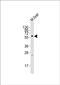 Nuclear Receptor Binding Protein 2 antibody, PA5-72212, Invitrogen Antibodies, Western Blot image 