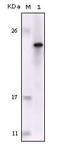 FES Proto-Oncogene, Tyrosine Kinase antibody, M01453, Boster Biological Technology, Western Blot image 