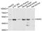 Sorting Nexin 5 antibody, A13160, ABclonal Technology, Western Blot image 