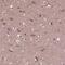 RUN And FYVE Domain Containing 3 antibody, HPA022970, Atlas Antibodies, Immunohistochemistry paraffin image 