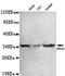 Serine/threonine-protein phosphatase 4 catalytic subunit antibody, GTX49198, GeneTex, Western Blot image 