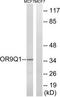 Olfactory Receptor Family 9 Subfamily Q Member 1 antibody, TA316241, Origene, Western Blot image 