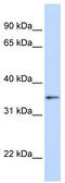 G Protein Subunit Beta 1 antibody, TA335042, Origene, Western Blot image 