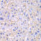 Enoyl-CoA Hydratase And 3-Hydroxyacyl CoA Dehydrogenase antibody, 15-015, ProSci, Immunohistochemistry paraffin image 