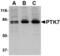 Protein Tyrosine Kinase 7 (Inactive) antibody, TA306461, Origene, Western Blot image 