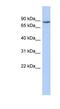 Transmembrane And Tetratricopeptide Repeat Containing 1 antibody, NBP1-62335, Novus Biologicals, Western Blot image 