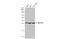 NADH:Ubiquinone Oxidoreductase Core Subunit S3 antibody, GTX105835, GeneTex, Western Blot image 