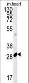 Apolipoprotein B MRNA Editing Enzyme Catalytic Subunit 2 antibody, LS-C156416, Lifespan Biosciences, Western Blot image 