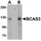 BCAS3 Microtubule Associated Cell Migration Factor antibody, A07120-1, Boster Biological Technology, Western Blot image 