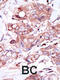 HER4 antibody, 63-073, ProSci, Immunohistochemistry paraffin image 