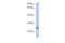 Tetratricopeptide Repeat Domain 9C antibody, PA5-70142, Invitrogen Antibodies, Western Blot image 