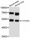 Cytochrome P450 Family 26 Subfamily B Member 1 antibody, STJ114035, St John