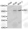 Insulin Receptor Substrate 1 antibody, A0245, ABclonal Technology, Western Blot image 