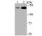 Chromatin Assembly Factor 1 Subunit A antibody, A02732, Boster Biological Technology, Western Blot image 