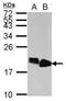 High Mobility Group AT-Hook 2 antibody, TA308757, Origene, Western Blot image 