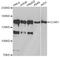 Cell Division Cycle And Apoptosis Regulator 1 antibody, A13595, ABclonal Technology, Western Blot image 