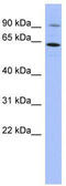 Zinc Finger Protein 778 antibody, TA345623, Origene, Western Blot image 