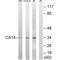 Carbonic Anhydrase 14 antibody, A06411, Boster Biological Technology, Western Blot image 