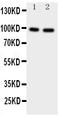 Transient Receptor Potential Cation Channel Subfamily V Member 4 antibody, PA1979, Boster Biological Technology, Western Blot image 