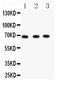 Nuclear Receptor Subfamily 4 Group A Member 2 antibody, PB9297, Boster Biological Technology, Western Blot image 
