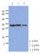 Troponin I1, Slow Skeletal Type antibody, MBS200239, MyBioSource, Western Blot image 