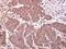 LIM Domain Only 4 antibody, NBP2-43538, Novus Biologicals, Immunohistochemistry frozen image 