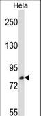 Tripartite Motif Containing 37 antibody, LS-C157273, Lifespan Biosciences, Western Blot image 