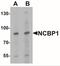 Nuclear Cap Binding Protein Subunit 1 antibody, NBP2-41222, Novus Biologicals, Western Blot image 