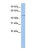 TSPY Like 4 antibody, NBP1-56289, Novus Biologicals, Western Blot image 